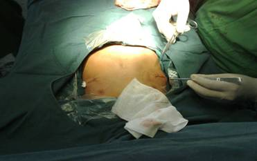 圖片25.png 圖片25.png